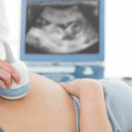 Cropped image of doctor performing ultrasound on pregnant woman in clinic
